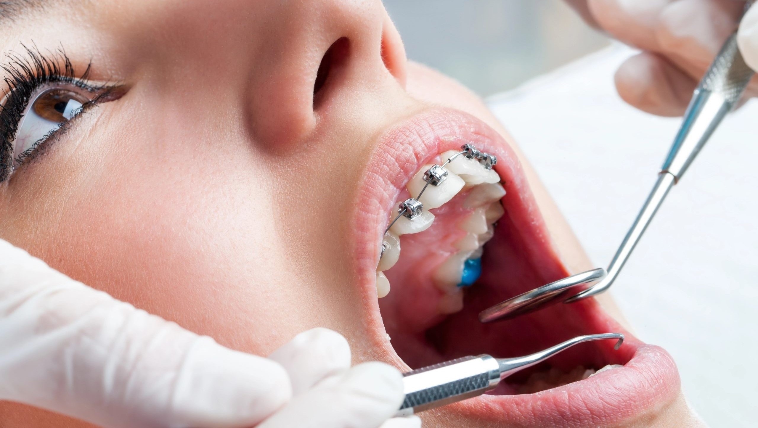 Affordable dental treatments in Lucknow clinic