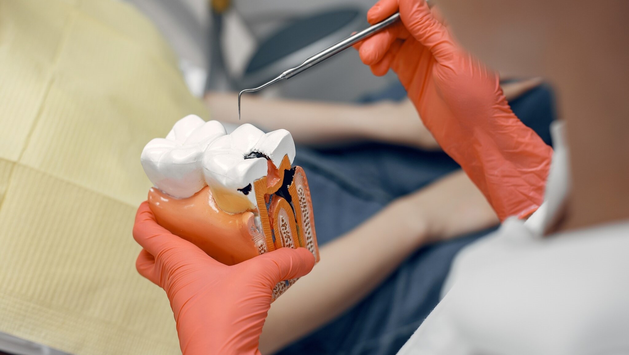 Painless root canal treatment at INDRM Lucknow