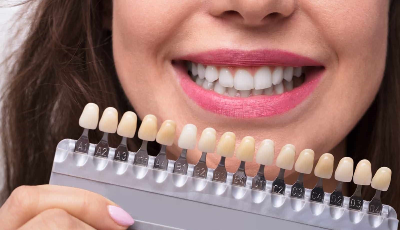 Laser teeth whitening procedure for brighter smile